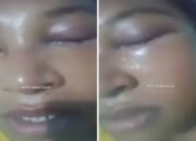 Sadis Suami Aniaya Istri Sampai Buta dan Berdarah