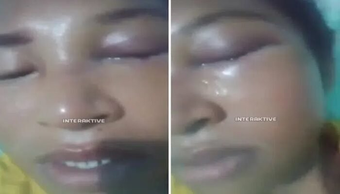 Sadis Suami Aniaya Istri Sampai Buta dan Berdarah