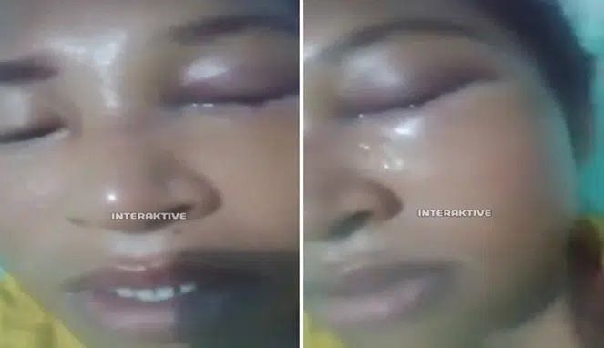 Sadis Suami Aniaya Istri Sampai Buta dan Berdarah