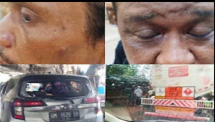 Teror Mafia di Sumbar! Wartawan Nyaris Tewas Saat Bongkar Tambang Ilegal