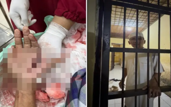 Melawan Dugaan Prostitusi Berujung Petaka, Hz Dikeroyok Sadis lalu Dipenjara