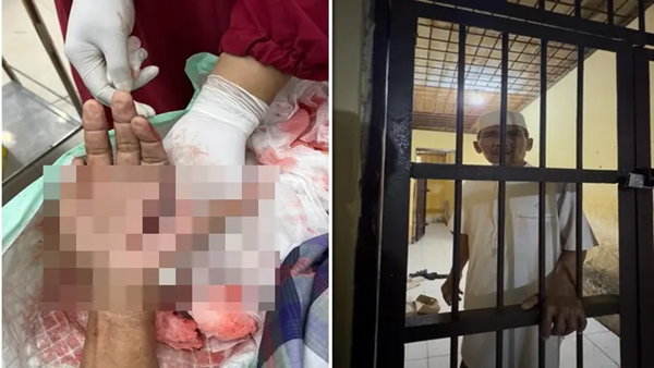 Melawan Dugaan Prostitusi Berujung Petaka, Hz Dikeroyok Sadis lalu Dipenjara